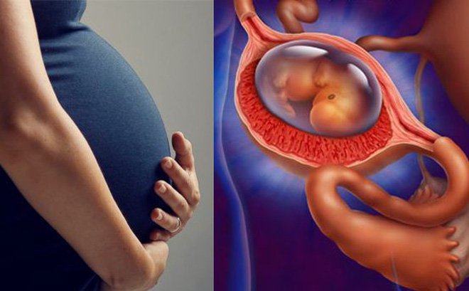 mang thai ngoài tử cung thử que có lên 2 vạch không