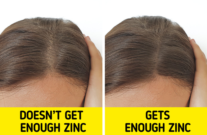 7 cách làm tóc chắc khỏe bạn không nên bỏ qua 