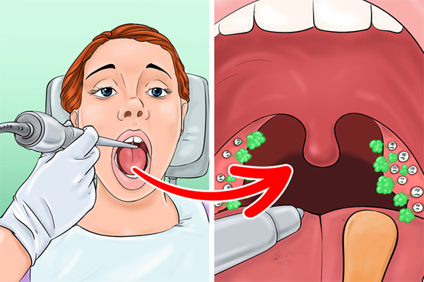 Chứng hôi miệng do đâu?