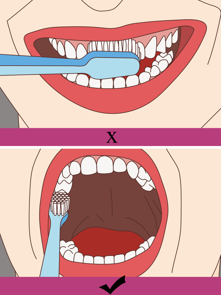Lưu ý chăm sóc răng miệng đúng cách